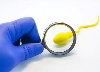 O m&eacute;dico examina os espermatozoides com uma lupa