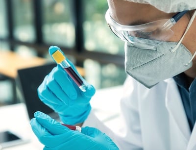 Ein Forscher f&uuml;hrt im Labor eine Analyse von Blutproben eines Patienten durch.