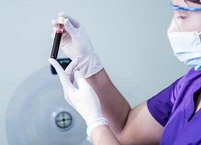 Zubereitung von pl&auml;ttchenreichem Plasma. R&ouml;hrchen mit Blut in den H&auml;nden einer medizinischen Fachkraft.