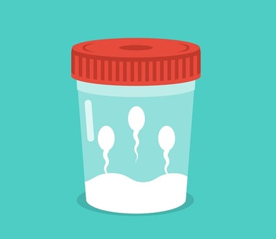 Spermaprobe in einem Glasr&ouml;hrchen