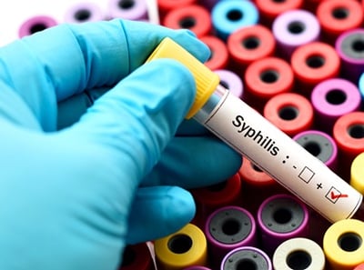 Bluttest f&uuml;r Syphilis